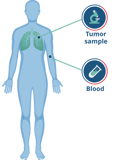 illustration of a human figure showing biomarkers found in tumor samples and blood